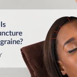 acupunture for migraine